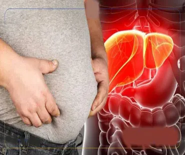 چاقی، بیماری پیش‌رونده قرن