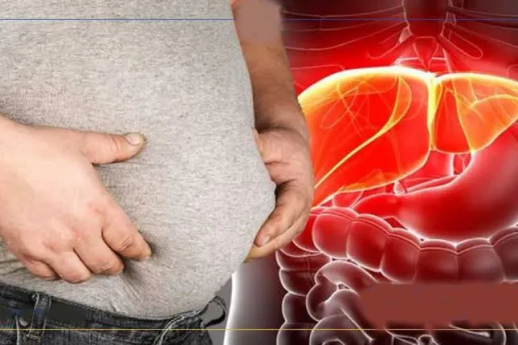 چاقی، بیماری پیش‌رونده قرن