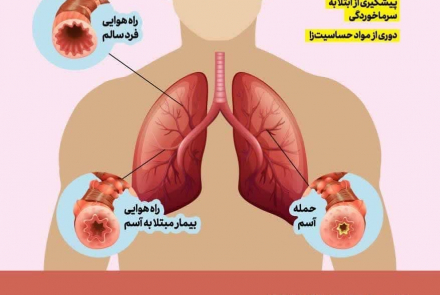 روز جهانی آسم