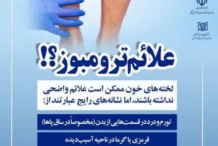 ترومبوز چیست